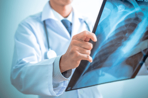 Wird eine Altersfeststellung auf medizinischen Weg angeordnet, sind Röntgenuntersuchungen die gängigste Methode.
